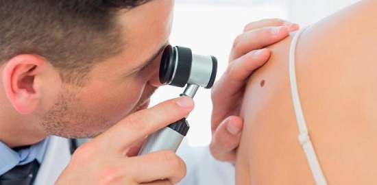 cáncer de piel cáncer de piel