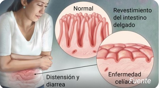 persona con celiqua