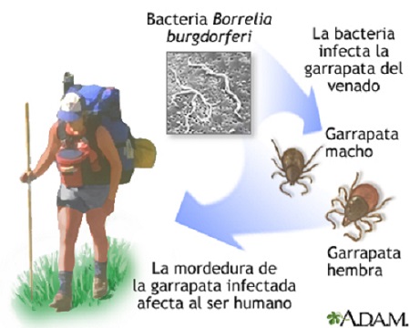 factores de riesgo