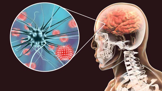 tipos de meningitis tipos de meningitis