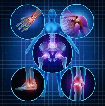 sntomas de la osteoporosis