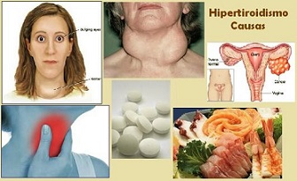 causas del hipertiroidismo