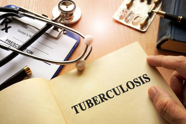 tuberculosis