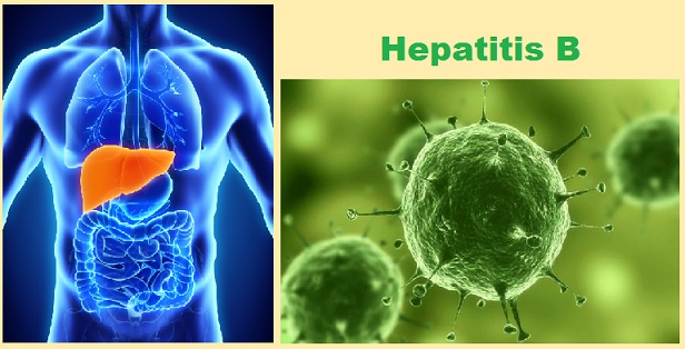 qu es la hepatitis b