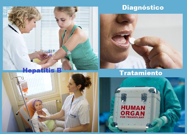 tratamiento de la hepatitis b