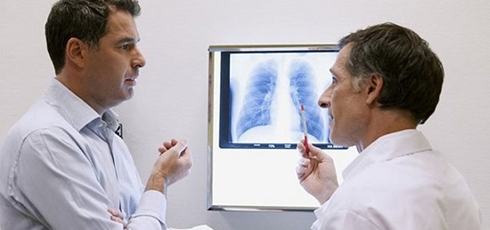rayos x del pulmn