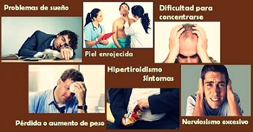 síntomas del hipertiroidismo