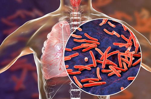 mycrobacterium tuberculosis